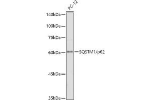 Western Blotting (WB) image for anti-Sequestosome 1 (SQSTM1) antibody (ABIN7270205)