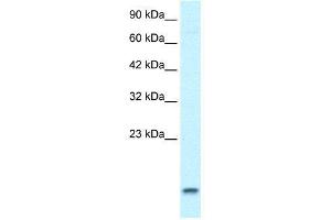 WB Suggested Anti-UBE2N  Antibody Titration: 1. (UBE2N 抗体  (Middle Region))