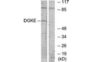 Western Blotting (WB) image for anti-Diacylglycerol Kinase, epsilon 64kDa (DGKE) (AA 161-210) antibody (ABIN2889507) (DGKE 抗体  (AA 161-210))