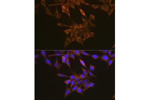 Immunofluorescence (IF) image for anti-Fms-Related tyrosine Kinase 1 (VEGFR1) (FLT1) (AA 1100-1200) antibody (ABIN1683256)