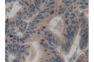 Immunohistochemistry (IHC) image for anti-Glutamate Decarboxylase 2 (Pancreatic Islets and Brain, 65kDa) (GAD2) (AA 65-105) antibody (ABIN7433339)