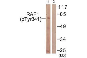 Western Blotting (WB) image for anti-V-Raf-1 Murine Leukemia Viral Oncogene Homolog 1 (RAF1) (pTyr341) antibody (ABIN1847298) (RAF1 抗体  (pTyr341))