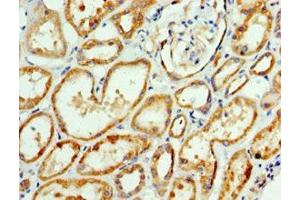 Immunohistochemistry of paraffin-embedded human kidney tissue using ABIN7144352 at dilution of 1:100 (AP1m2 抗体  (AA 164-423))