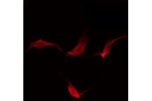 ABIN6274142 staining HuvEc by IF/ICC. (MAP4K4 抗体  (Internal Region))