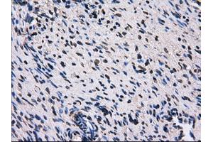 Immunohistochemical staining of paraffin-embedded liver tissue using anti-RPA2 mouse monoclonal antibody. (RPA2 抗体)