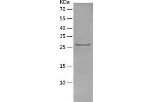 Western Blotting (WB) image for Protein tyrosine Phosphatase, Receptor Type, J (PTPRJ) (AA 1024-1306) protein (His tag) (ABIN7124686) (PTPRJ Protein (AA 1024-1306) (His tag))