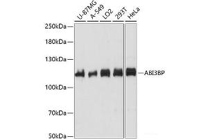 Western blot analysis of extracts of various cell lines using ABI3BP Polyclonal Antibody at dilution of 1:1000. (ABI3BP 抗体)