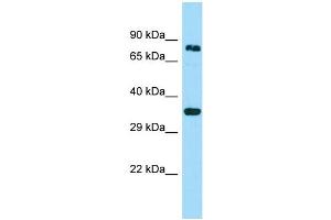 WB Suggested Anti-HOOK3 Antibody Titration: 1. (HOOK3 抗体  (C-Term))
