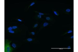 Immunofluorescence of purified MaxPab antibody to IFIT2 on HeLa cell. (IFIT2 抗体  (AA 1-484))