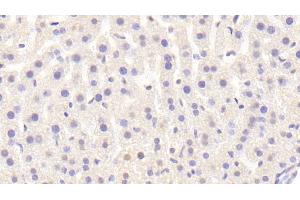 Detection of Raftlin in Mouse Liver Tissue using Polyclonal Antibody to Raft Linking Protein (Raftlin) (RFTN1 抗体  (AA 207-451))