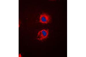 Immunofluorescent analysis of EPS8L2 staining in HeLa cells. (EPS8-Like 2 抗体  (N-Term))