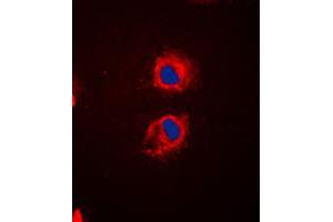 Immunofluorescent analysis of EPS8L2 staining in HeLa cells. (EPS8-Like 2 抗体  (N-Term))