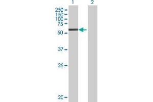 Lane 1: C1S transfected lysate ( 76. (C1S 293T Cell Transient Overexpression Lysate(Denatured))