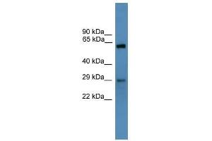 Western Blot showing TP53RK antibody used at a concentration of 1-2 ug/ml to detect its target protein. (TP53RK 抗体  (N-Term))
