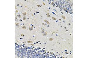 Immunohistochemistry of paraffin-embedded rat brain using ITGA2 Antibody. (ITGA2 抗体)