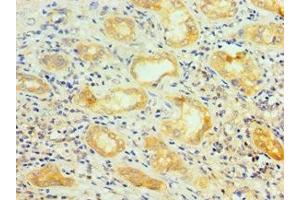Immunohistochemistry of paraffin-embedded human kidney tissue using ABIN7168971 at dilution of 1:100 (SRSF4 抗体  (AA 1-180))
