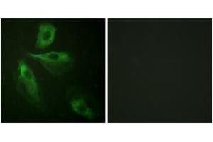 Immunofluorescence analysis of HeLa cells, using ADD1 (Ab-445) Antibody. (alpha Adducin 抗体  (AA 411-460))