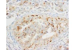 OPCML Polyclonal Antibody (OPCML 抗体  (C-Term))