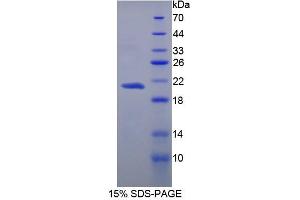 SDS-PAGE analysis of Human Carboxypeptidase N1 Protein. (CPN1 蛋白)