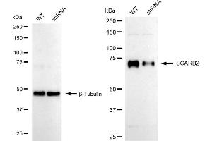 Western blotting analysis using SCARB2 antibody (ABIN7800277).