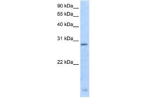 WB Suggested Anti-RGS18 Antibody Titration:  5. (RGS18 抗体  (N-Term))