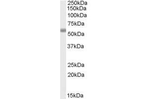 Western Blotting (WB) image for anti-Family with Sequence Similarity 177, Member B (FAM177B) (C-Term) antibody (ABIN2791531) (FAM177B 抗体  (C-Term))