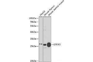 Western blot analysis of extracts of various cell lines using GTF2F2 Polyclonal Antibody at dilution of 1:1000. (GTF2F2 抗体)