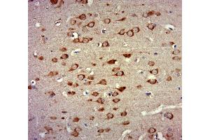 Paraformaldehyde-fixed, paraffin embedded rat brain, Antigen retrieval by boiling in sodium citrate buffer (pH6. (ZNF346 抗体  (AA 181-294))
