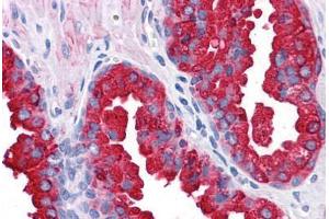 Human Prostate: Formalin-Fixed, Paraffin-Embedded (FFPE) (ERG 抗体  (AA 1-160))