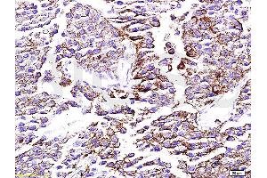 Formalin-fixed and paraffin embedded rat testis tissue labeled with Anti-mTOR Polyclonal Antibody, Unconjugated (ABIN676403) at 1:200 followed by conjugation to the secondary antibody, Goat Anti-Rabbit IgG, PE conjugated and DAPI staining (MTOR 抗体  (AA 2436-2492))