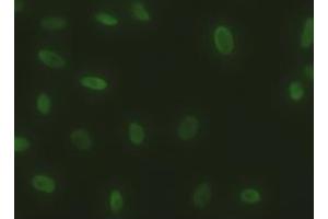 Immunofluorescent staining of HeLa cells using anti-SOX17 mouse monoclonal antibody (ABIN2452369). (SOX17 抗体  (AA 177-414))