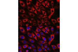 Immunofluorescence analysis of NIH/3T3 cells using UFL1 Rabbit pAb (ABIN7271213) at dilution of 1:50 (40x lens). (UFL1 抗体)