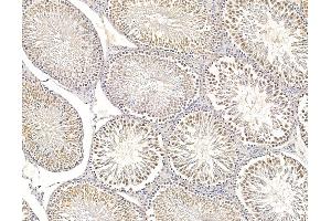 ABIN6266002 and ABIN6279803 at 1/100 staining rat testis tissue by IHC-P.