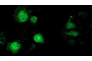 Anti-MAPRE2 mouse monoclonal antibody (ABIN2454593) immunofluorescent staining of COS7 cells transiently transfected by pCMV6-ENTRY MAPRE2 (RC200259). (MAPRE2 抗体)