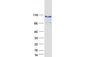 Western Blotting (WB) image for PiggyBac Transposable Element Derived 1 (PGBD1) protein (Myc-DYKDDDDK Tag) (ABIN2728780)