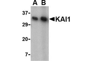 Western Blotting (WB) image for anti-CD82 (CD82) (C-Term) antibody (ABIN1030462)