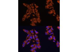 Immunofluorescence (IF) image for anti-Signal-Regulatory Protein alpha (SIRPA) (AA 395-504) antibody (ABIN6147780)