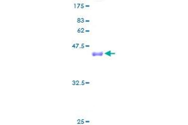 eIF4EBP2 Protein (AA 1-120) (GST tag)