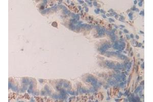 DAB staining on IHC-P; Samples: Rat Lung Tissue (PRCP 抗体  (AA 113-350))