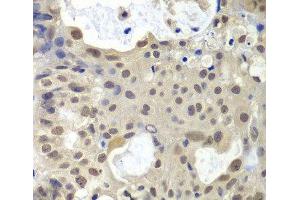 Immunohistochemistry (Paraffin-embedded Sections) (IHC (p)) image for anti-U2 Small Nuclear RNA Auxiliary Factor 1 (U2AF1) antibody (ABIN7007378)