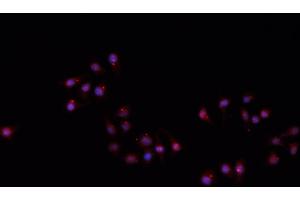 ABIN6266710 staining A549 cells by IF/ICC. (Hairless 抗体)