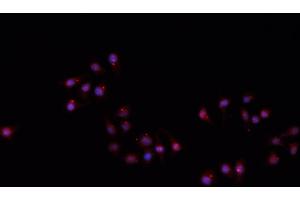 ABIN6266710 staining A549 cells by IF/ICC. (Hairless 抗体)