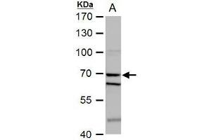 WB Image SHP1 antibody detects SHP1 protein by western blot analysis. (SHP1 抗体)