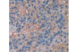 IHC-P analysis of Mouse Tissue, with DAB staining. (ITK 抗体  (AA 368-625))