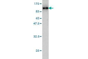 Western Blot detection against Immunogen (89. (Radixin 抗体  (AA 1-583))