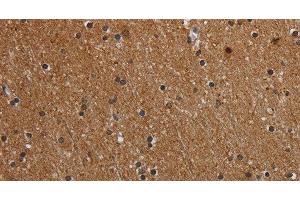 Immunohistochemistry of paraffin-embedded Human brain using MT-ND1 Polyclonal Antibody at dilution of 1:50 (MT-ND1 抗体)