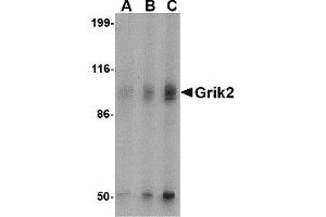 Western Blotting (WB) image for anti-Glutamate Receptor, Ionotropic, Kainate 2 (GRIK2) antibody (ABIN1030201) (GRIK2 抗体)