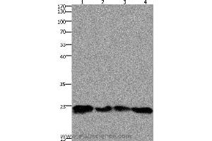 Western blot analysis of 293T and hela cell, mouse lung and brain tissue, using HMGB3 Polyclonal Antibody at dilution of 1:400 (HMGB3 抗体)