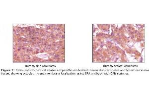 Image no. 1 for anti-Steroid Receptor RNA Activator 1 (SRA1) antibody (ABIN232101) (SRA1 抗体)