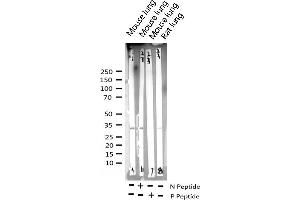 Western blot analysis of Phospho-CDC2 (Tyr15) expression in various lysates (CDK1 抗体  (pTyr15))